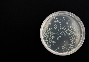 Maior resistência aos antibióticos das comunidades de bactérias e a sua maior capacidade para causar infeção estão relacionadas, revela estudo